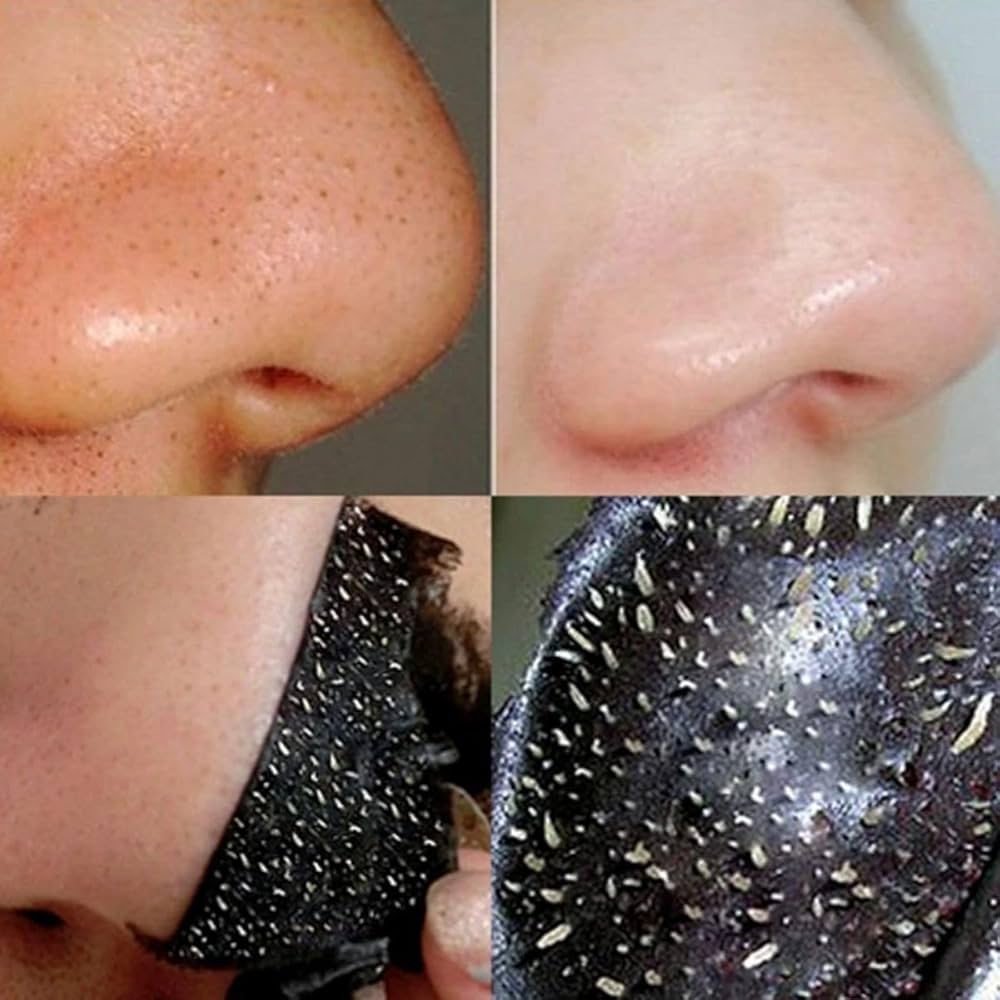 Mascarilla unisex para remover puntos negros